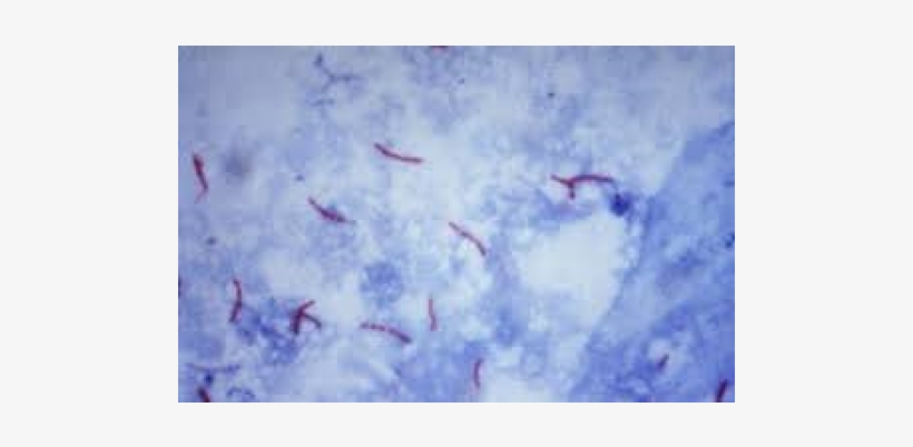 Prepared Slides, Mycobas, Tuberculosis Smear, Pk/50 - Sputum Afb Positive 3+, transparent png