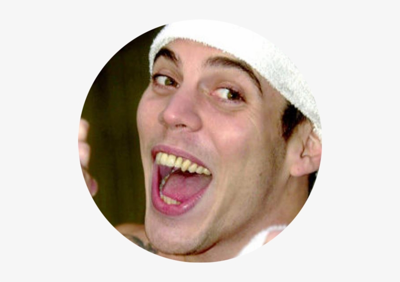 Steve-o - Steve O Before And After, transparent png