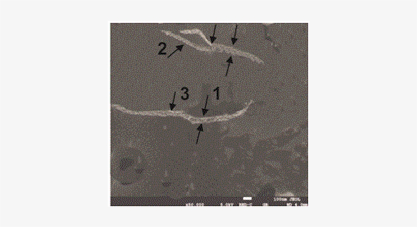 The Sem Picture Of The Suspension Of Amylin, Aggregated - Metal, transparent png