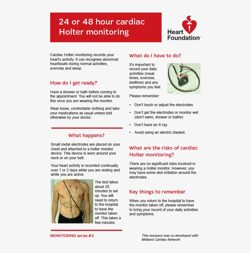 What Is Cardiac Holter Monitoring - Alt Attribute, transparent png