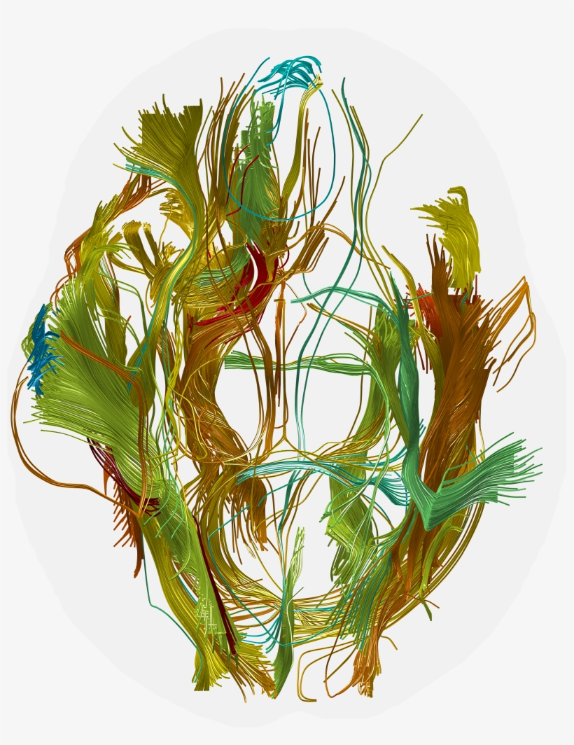 Individually Control The Tract Bundle Colors To Reflect - Illustration, transparent png