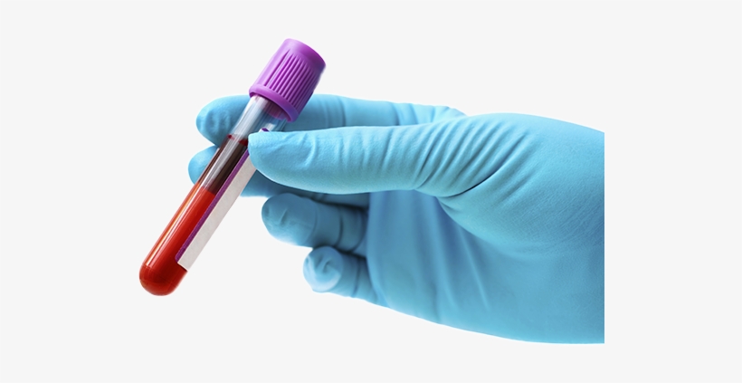 Future - Bioanalysis Of Pharmaceuticals By Steen Honoré Hansen, transparent png