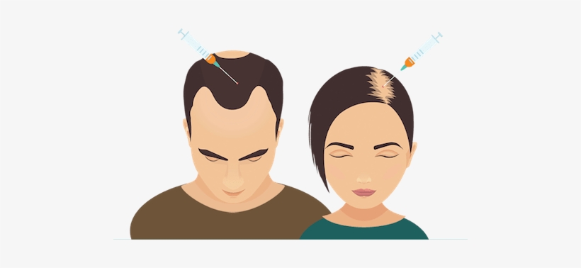 Prp Hair Loss - Stop Hair Loss Cartoon, transparent png