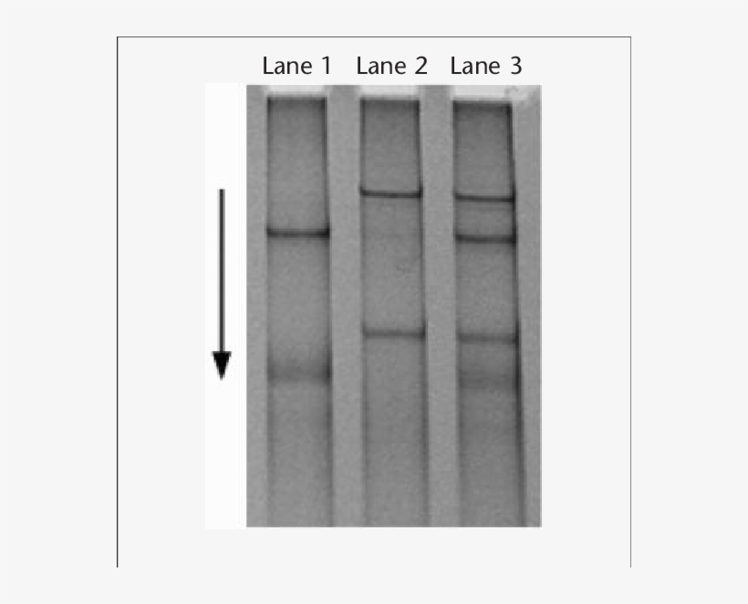 Caused By A T C Transition In The Sodium Channel, Voltage-gated, - Monochrome, transparent png