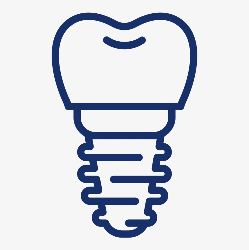 A Dental Implant Has Three Parts - Dentist, transparent png