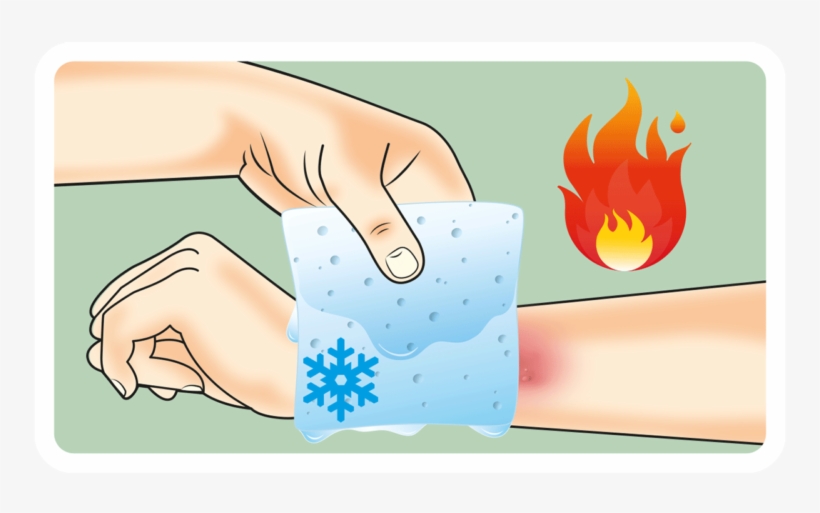Burns The A To Z Of Rapid Treatment - Burns, transparent png