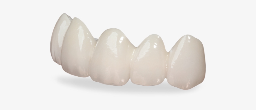 Lava Crowns And Bridges, transparent png