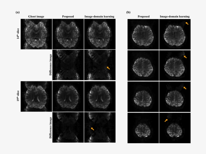 Comparison With The Image-domain Learning - Monochrome, transparent png