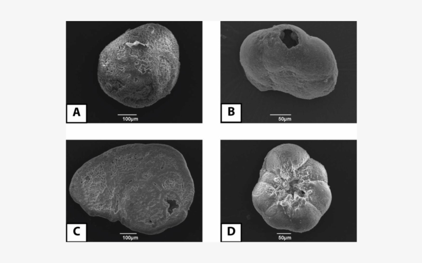 A) Rosalina Sp., (b) Aubignyna Sp. (broken), (c) Cibicides - Cibicides, transparent png