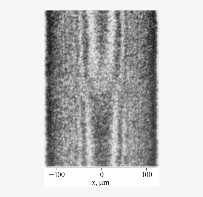 Fragment Of Experimental Section Topogram For The 220 - Scarf, transparent png