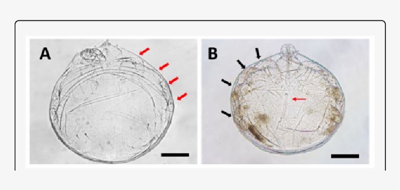 Tritonymph And Deutonymph Of Ophioptes Ekans Sp - Circle, transparent png