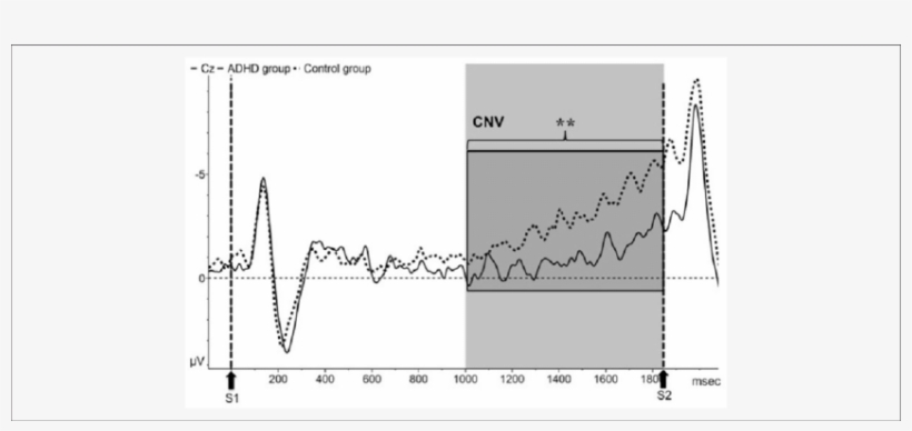 Event-related Potentials To The Warning Stimulus - Plot, transparent png