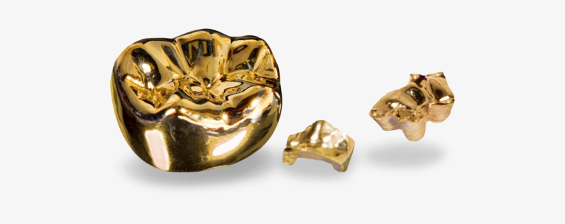 Pfm Lab Outsourcing Services - Cast Restorations, transparent png