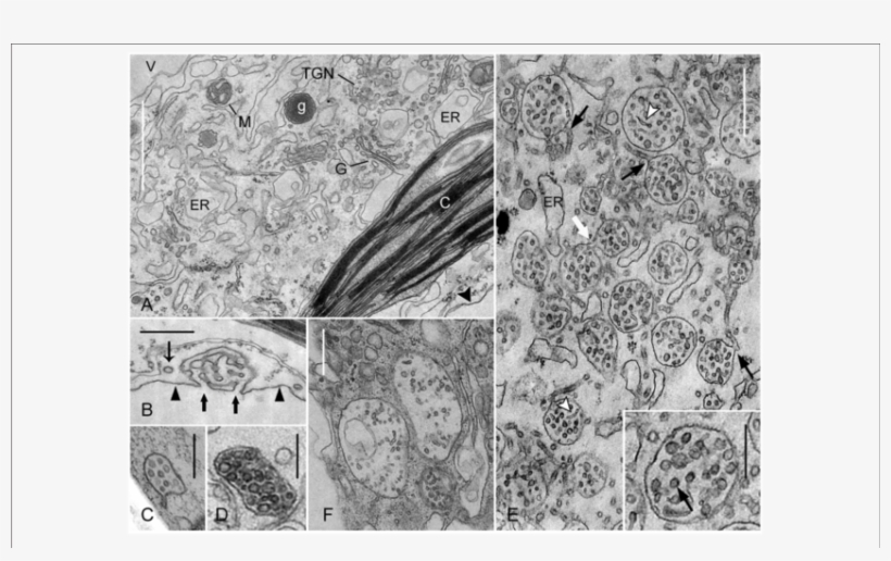 Effect Of Wortmannin On Mvbs In Chara Internodal Cells - Chara, transparent png