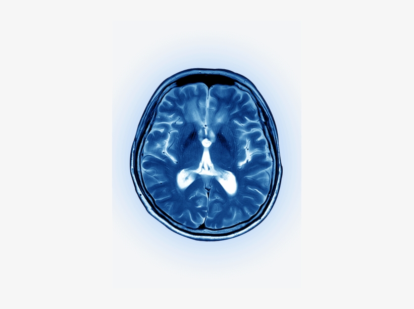 Brain Scan - Computed Tomography, transparent png