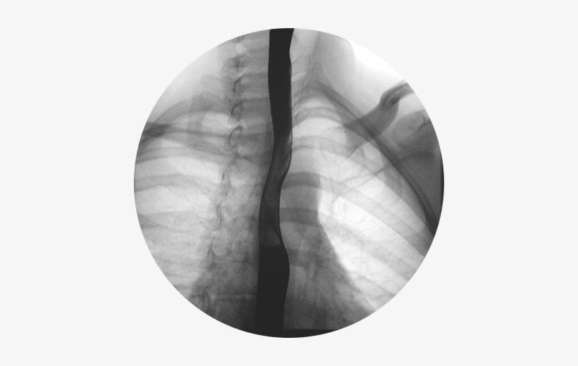 Fluoroscopy X Ray, transparent png