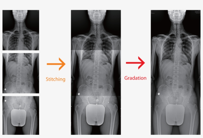 Adding Annotation Text, Graphics And Electronic Markers - X Ray Stitching, transparent png