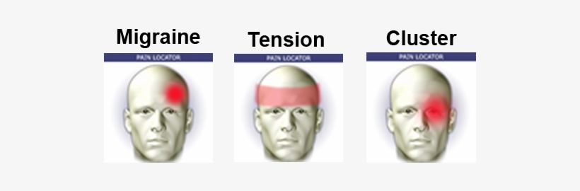 Have You Been Suffering From Constant Headaches / Migraines - Cluster Meaning In Urdu, transparent png