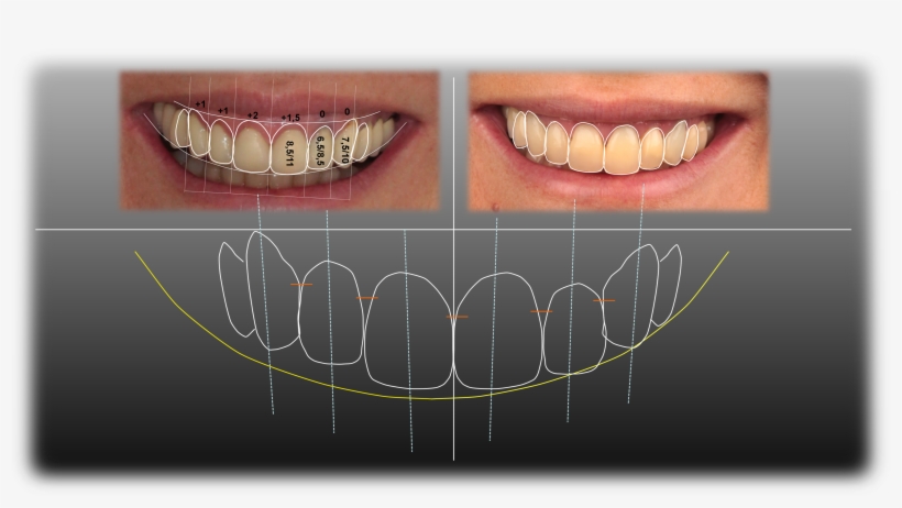 Silvestre Ripoll Clínica Dental - Diseño De La Sonrisa, transparent png