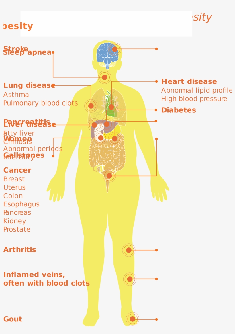 Open - Medical Complications Of Obesity, transparent png