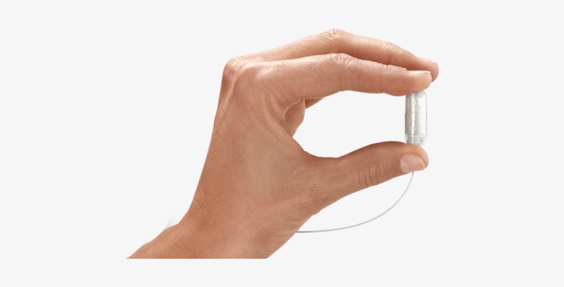 Obalon-capsule - Gastric Balloon, transparent png