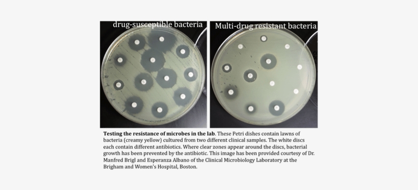 Bacterial Resistance Arises Through The Simple Process - Antibiotic Resistance Petri Dish, transparent png