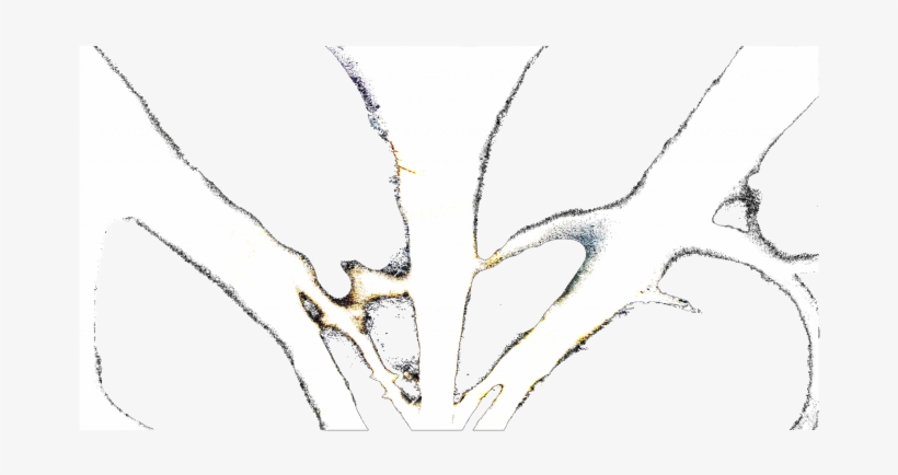 Remixes - Emblem, transparent png