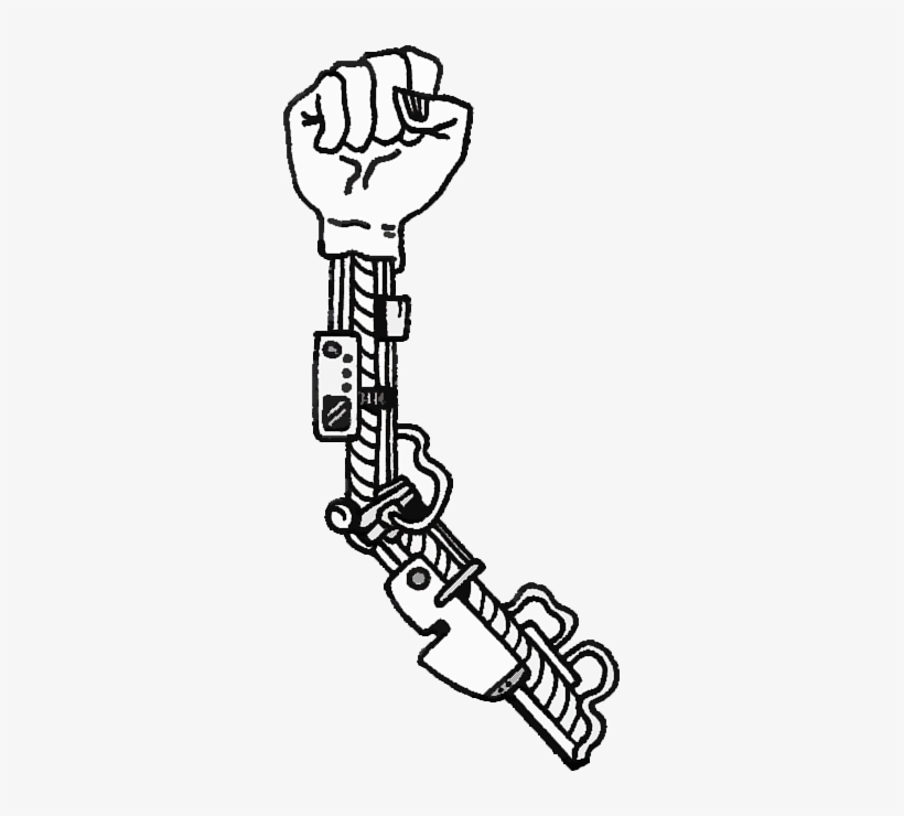 Surgeons Basically Dissect The Shoulder To Access The - Bionic Arm Clip Art, transparent png