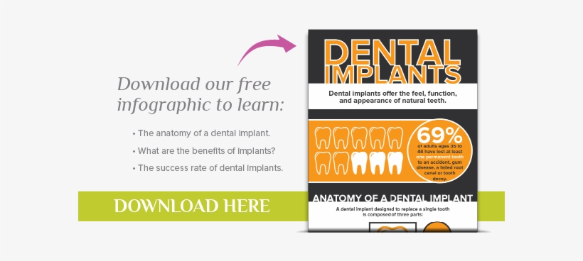 Anchorage Dentist - Dental Implant Offers, transparent png