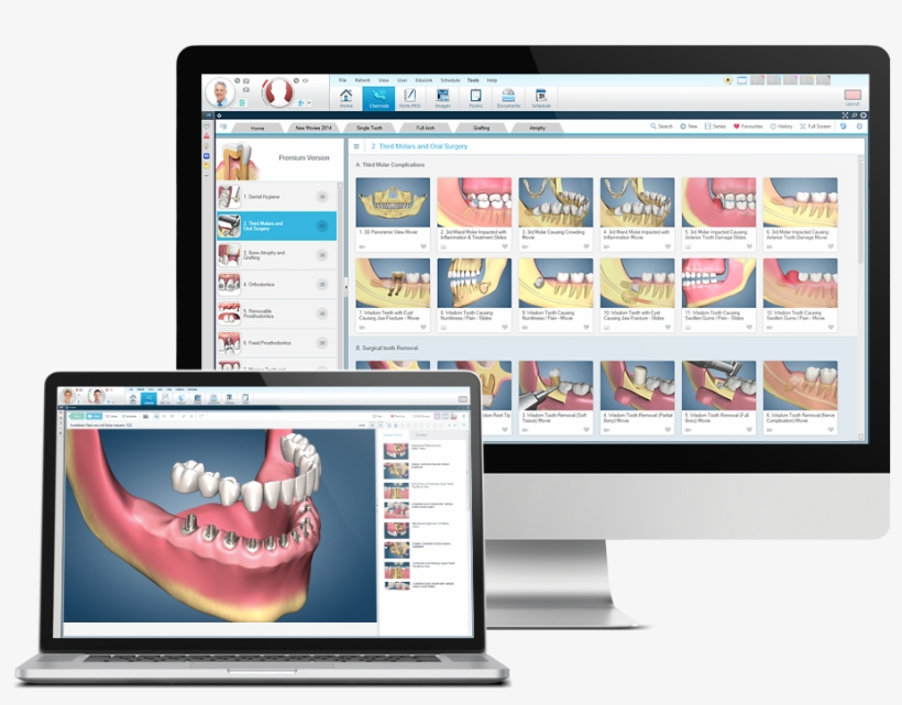 Dental Software Free Download Chairside Dental 912x690 PNG Download