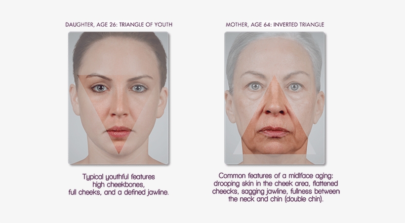 Mother And Daughter, Side By Side, Shows How The Contour - Face, transparent png