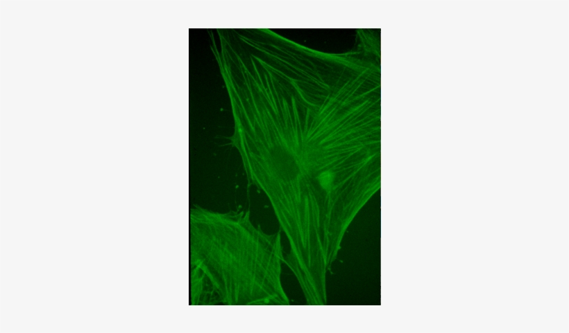 Mouse - Anti-actin Antibodies, transparent png
