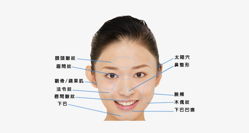 Radiesse-inject - Fasd Facial Features, transparent png