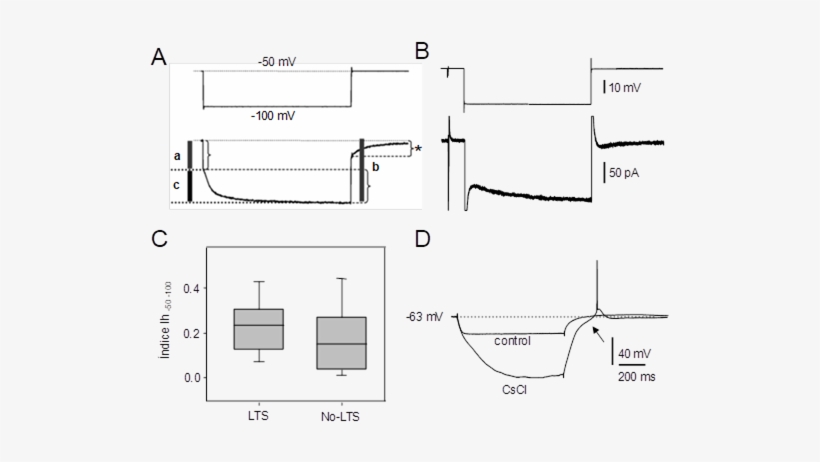 Esquema Del Procedimiento Empleado Para Cuantificar - Technical Drawing, transparent png