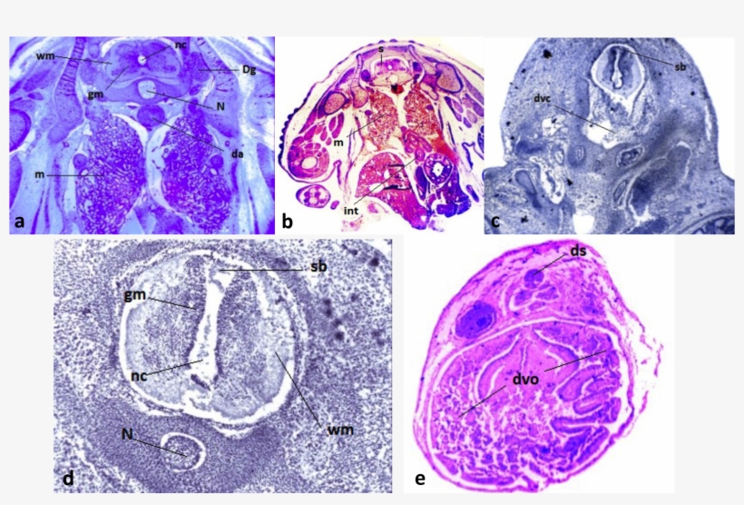 View Larger Version - Computed Tomography, transparent png