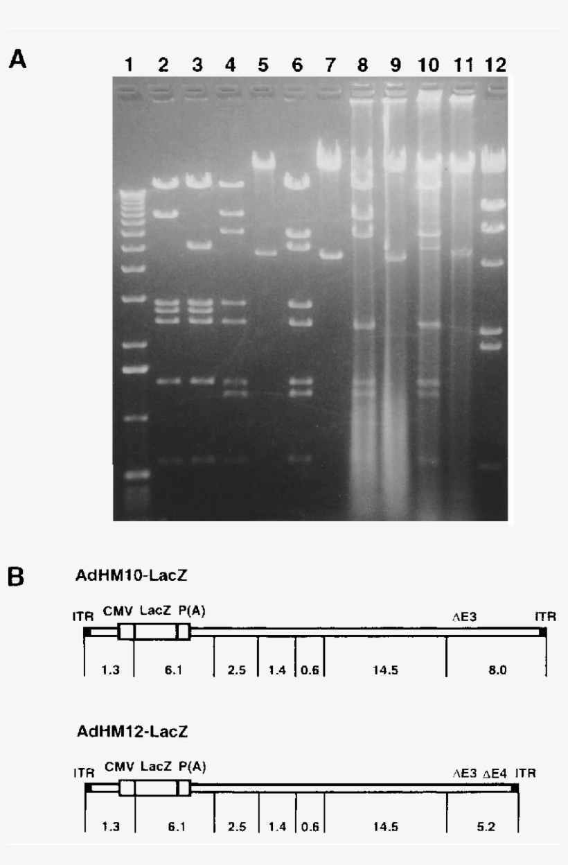 Restriction Endonuclease Analysis - Number, transparent png