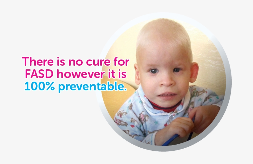 What Is Fasd - Alcohol Syndrome Babies, transparent png