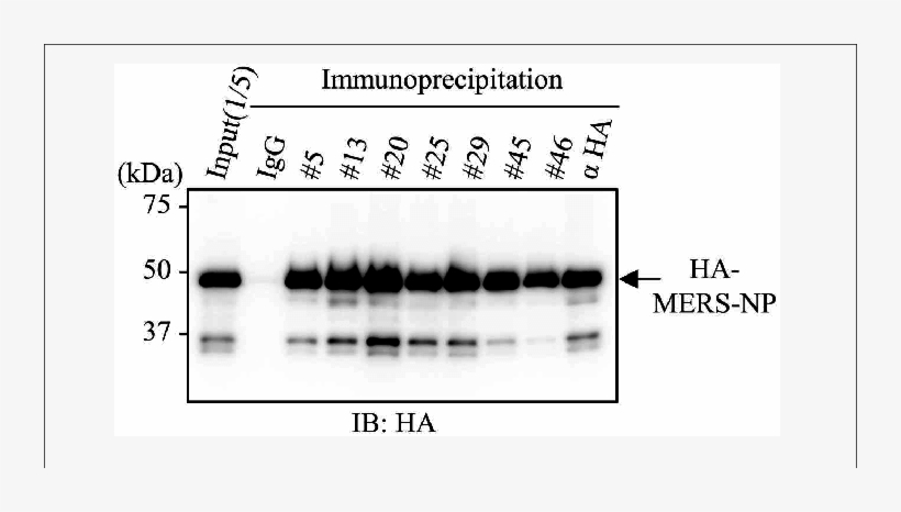 Immunoprecipitation Analysis With Generated Mabs, transparent png