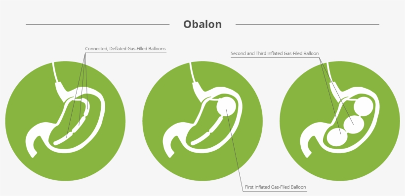 About Advanced Surgeons - Graphic Design, transparent png