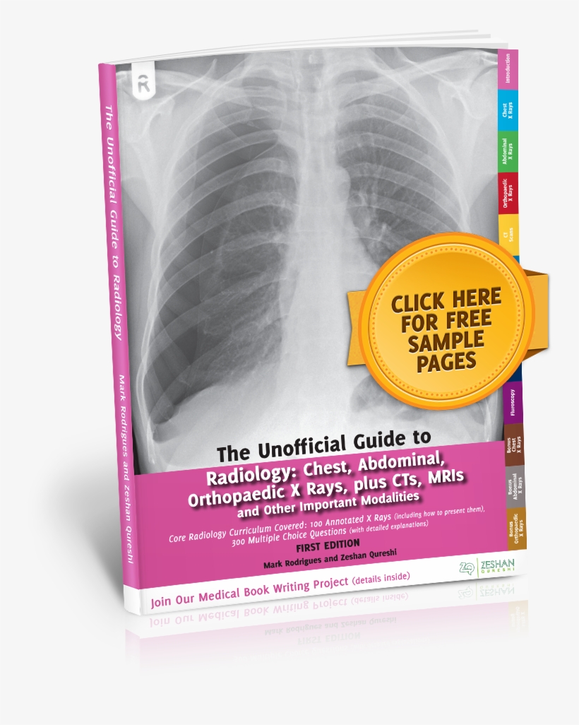 The Unoffical Guide To Medicine - Unofficial Guide To Radiology By Mark Rodrigues, transparent png