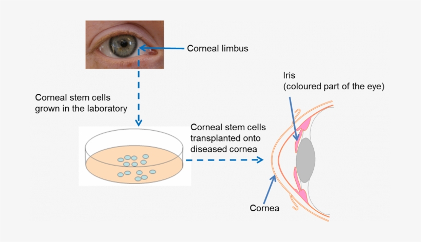 Stem Cell In Eye, transparent png