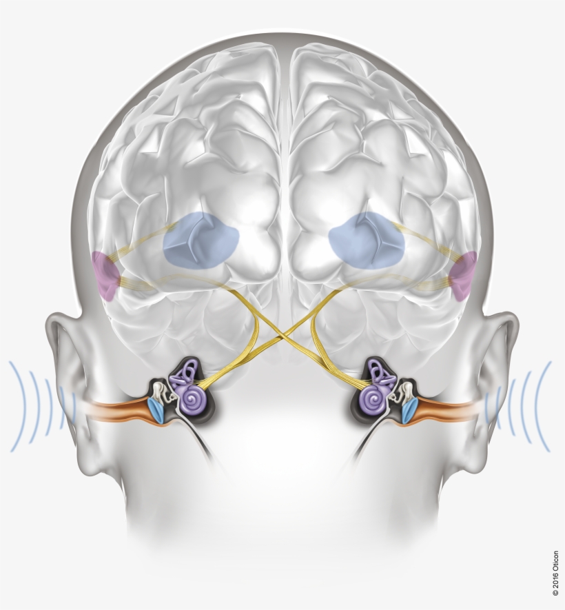 Oticon Velox Ears Brain Brainhearing Illustration Light - Velox Insurance, transparent png