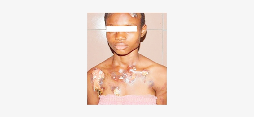 Health Worker Arrested For Inflicting Injuries, transparent png