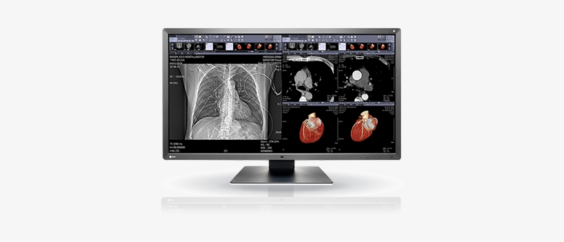 Mx315w - Eizo Mx315w, transparent png