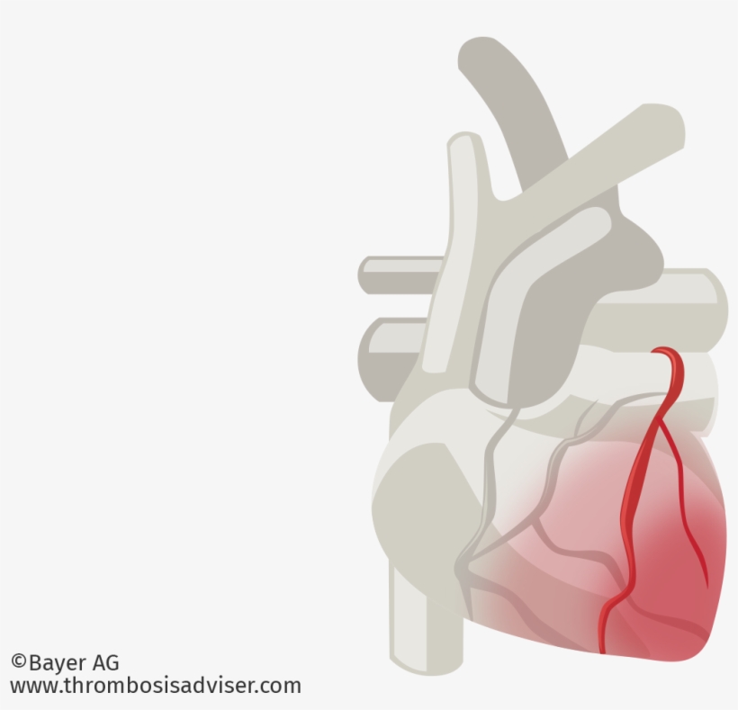 Cardiac Muscle Damage In Acs - Arterial Blood Gas Test, transparent png