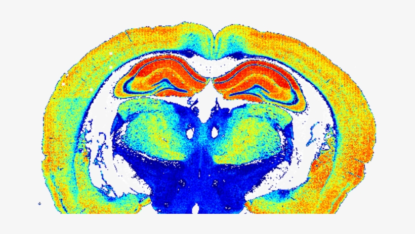 Article Update 82cf82e6 D658 45c5 A505 Adb114d9fdf4 - Brain, transparent png