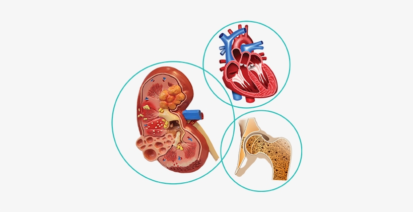 The Burden - Diagram, transparent png