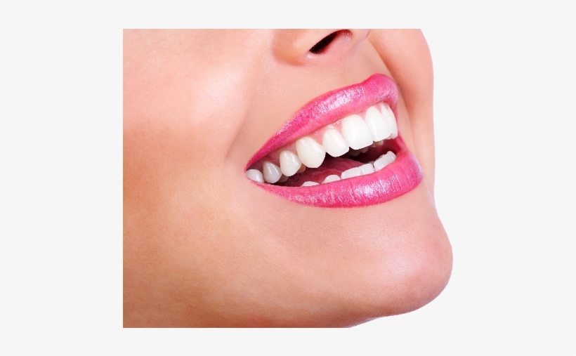 Teeth Whitening Centre London Ontario Smile Teeth 640x426 PNG