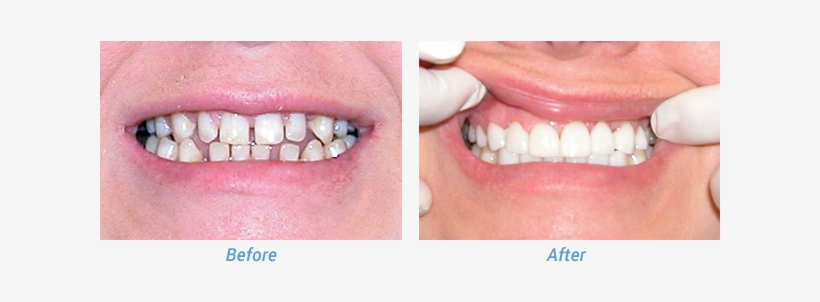 “i Always Hated My Smile - Tongue, transparent png