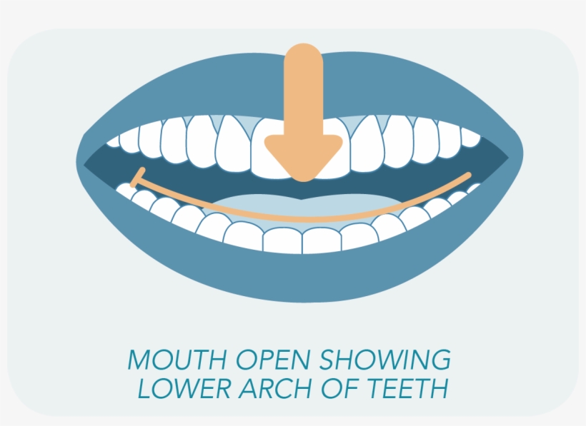 Want To Have An Impressions Doctor See If You're A - Mouth, transparent png